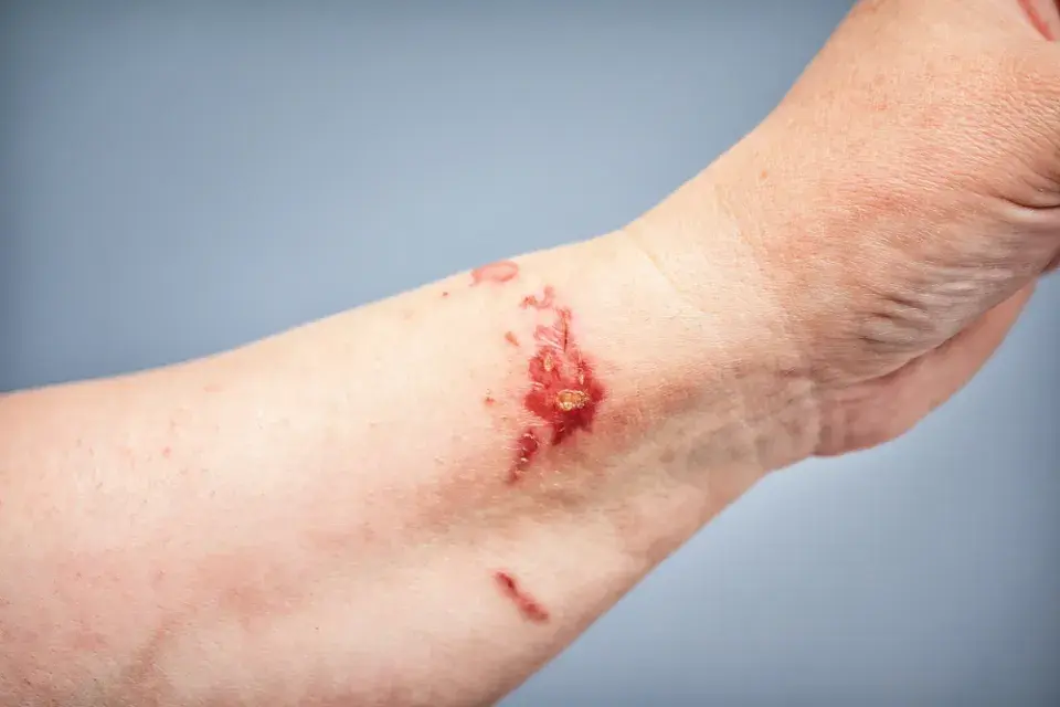 Třemdava bílá (Dictamnus albus) 